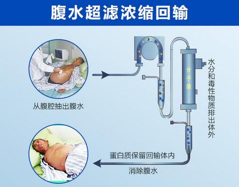 如何使肚子大,肚子大怎么判断是不是肝腹水