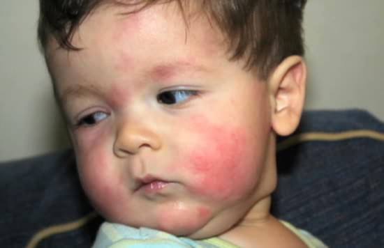 小小推荐益生菌,小小益生菌抗病毒