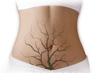 嘴巴和下巴周围长痘的原因怎么治,鼻翼两侧和下巴长痘什么原因引起