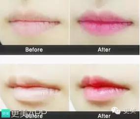 韩式半永久,韩式半永久都有什么