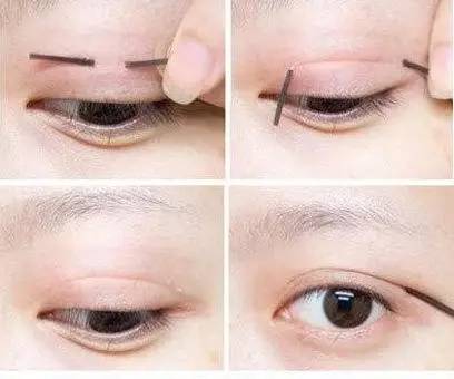哭多会成为双眼皮？变双眼皮的招数多着呢