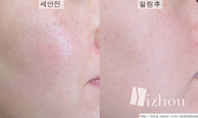 悦诗风吟最贵的系列,悦诗风吟值得购买的精华