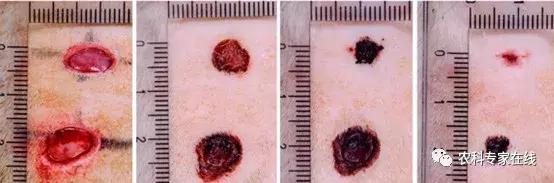 李春义|直径10厘米的伤口,1分钟止血,6天痊愈,谁是幕后推手?