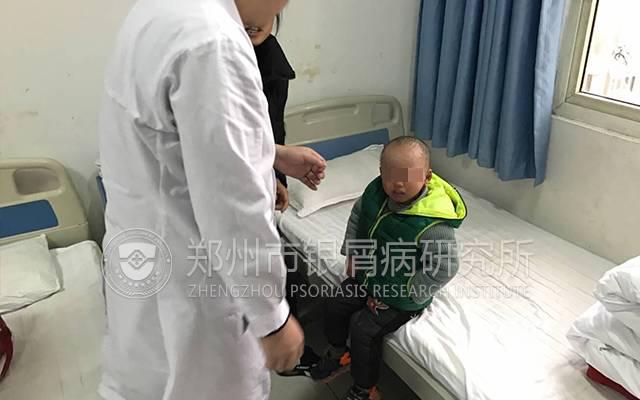 案例分享|四岁男童因误治变成沙皮人！