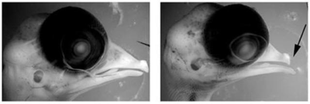 孕妇发烧了是吃药还是硬扛,孕妇发烧会不会影响宝宝智力