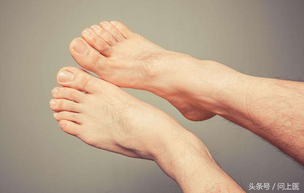 全身有体毛就是多毛症吗,病态性多毛症状