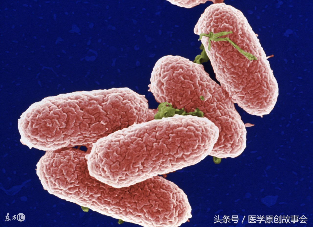 奶粉沙门氏细菌感染,法国带菌奶粉最新事件