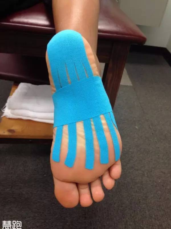 全球治好足跟痛,足底疗法治百病