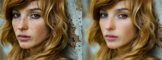 点的雀斑留色素了怎么办,表皮雀斑怎么去除