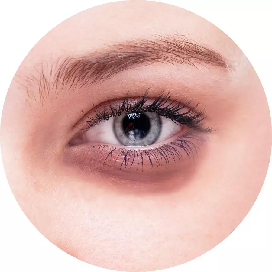 眼霜也要到年纪了才用,眼霜多大岁数适合用