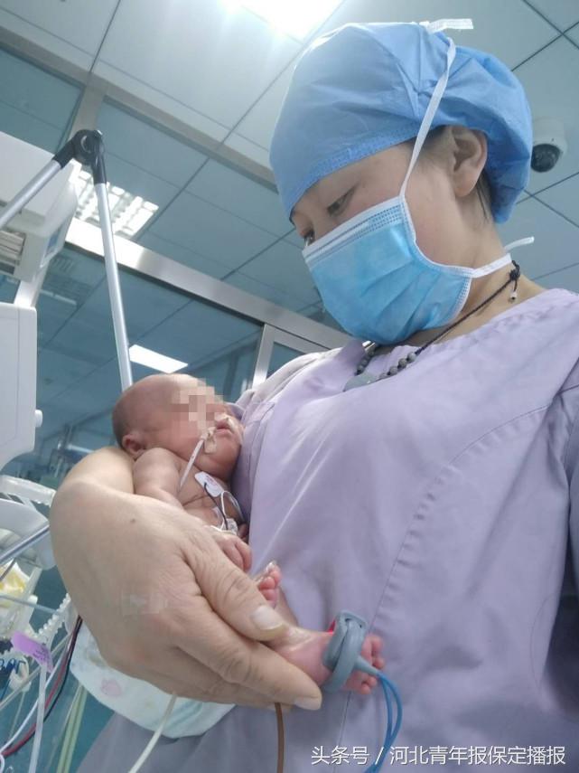 保定新生婴儿出生,生长受限的早产儿刚出生的照片