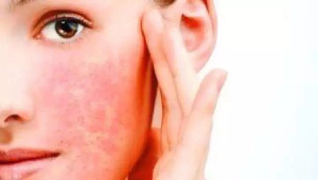 用了这样的护肤品，相当于你的皮肤在吃“*片鸦**”