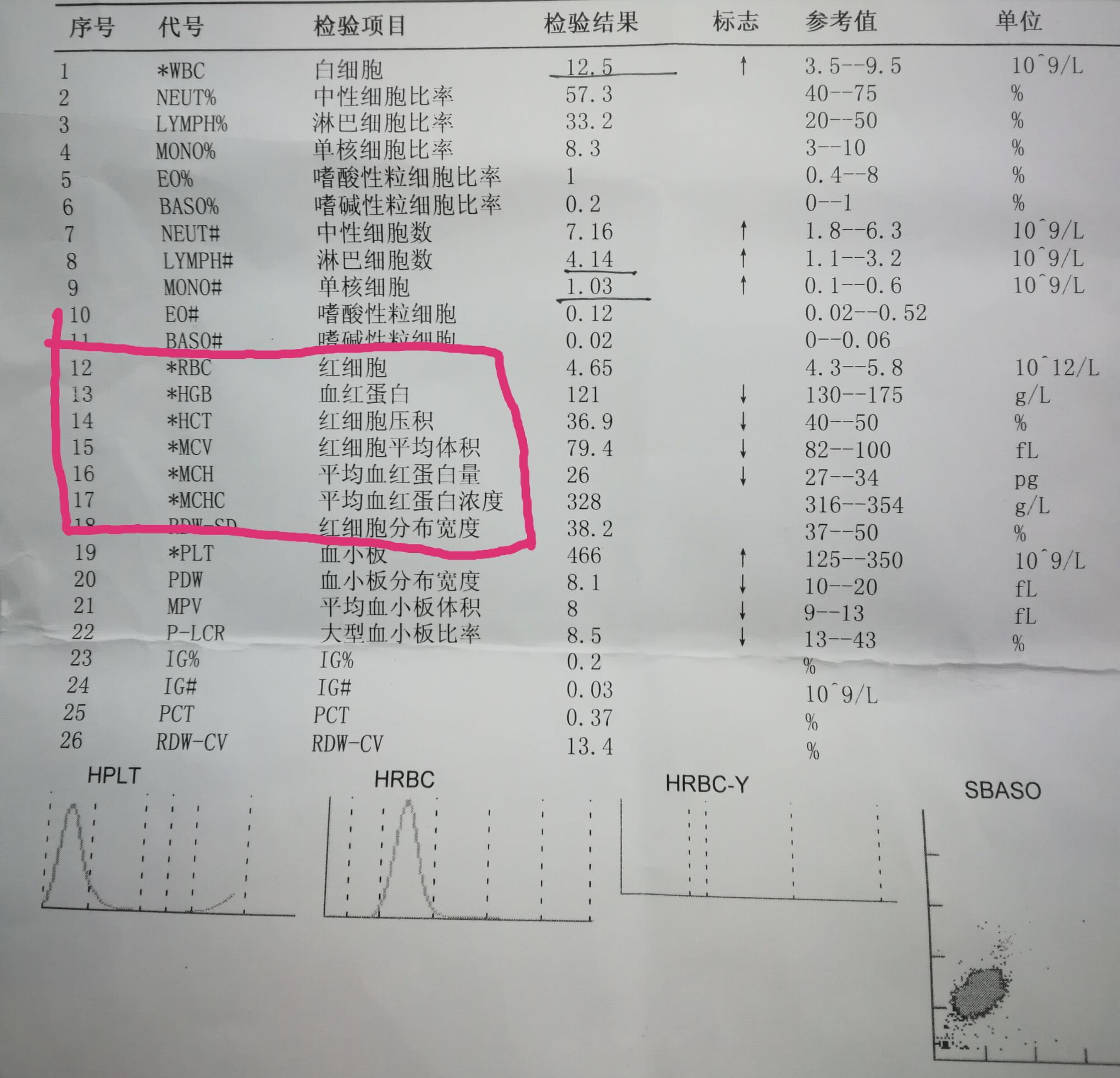 一分钟看懂化验单,化验单能看出肝功能不正常吗