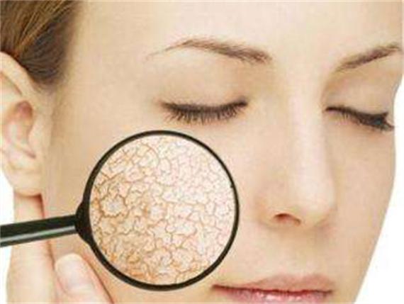 补水时脸上会有刺痛的感觉怎么办,贴补水面膜脸上刺痛是怎么回事