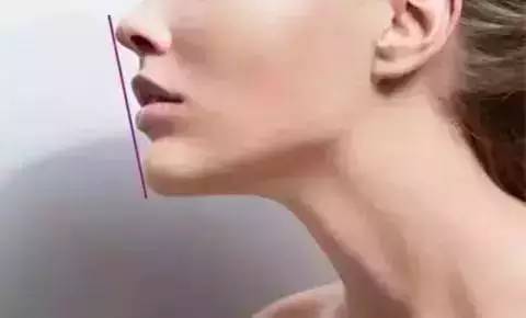 丰下巴用玻尿酸好还是自体脂肪好,玻尿酸丰下巴后要注意哪些问题