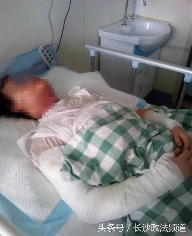 十六岁女生提分手被男友泼汽油,少女分手后被男朋友泼汽油