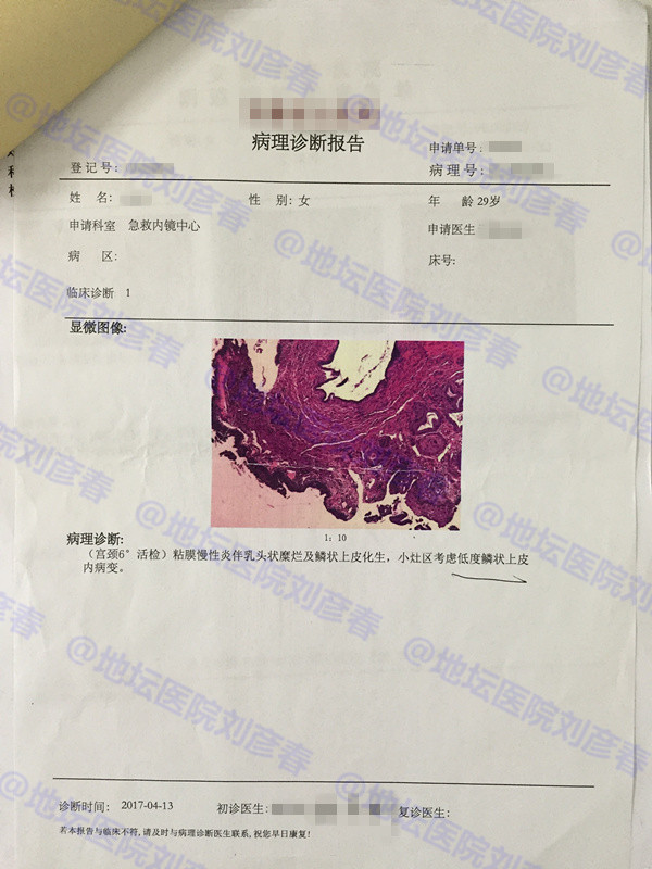 hpv18是尖锐性湿疣吗,hpv感染病例分享