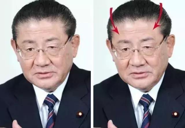 发际线不好看怎么剪,如何拯救90后的发际线