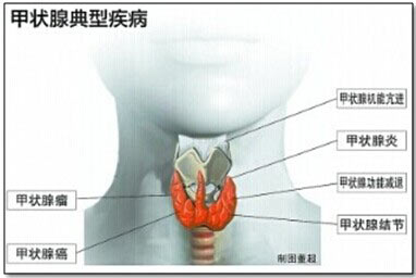 热敷甲状腺有作用吗,甲状腺的重要作用