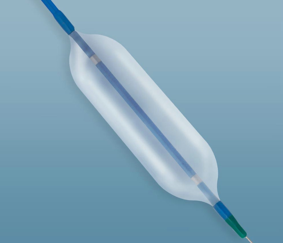 气囊导管扩张术治疗小儿包茎,气囊扩张解除粘连