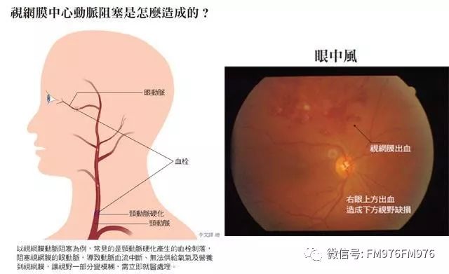 改善眼病有几种护眼方法,有眼病如何护眼