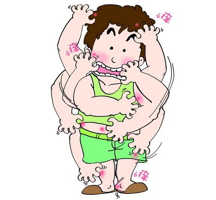 皮肤瘙痒一定是病吗,皮肤过敏瘙痒时要注意哪些