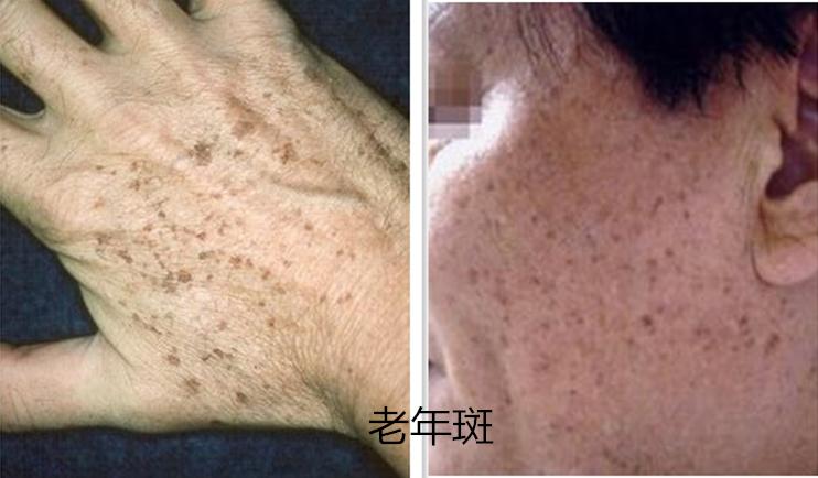 教你如何辨别斑的种类,一张图教你认识身体各个部位