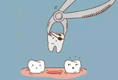 智齿发炎轻症和重症,智齿轻度龋坏怎么做