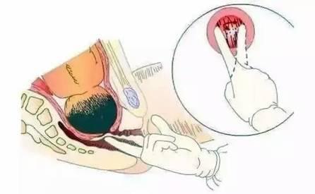 临产前半个小时,胎儿在干什么?太神奇太可爱了!