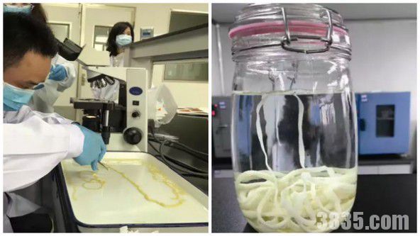 牛排寄生虫有多严重,吃半熟牛排会有寄生虫吗