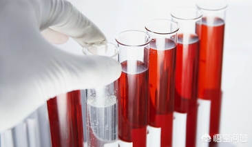 膀胱癌发现血尿还能活多久,发现血尿怎么办