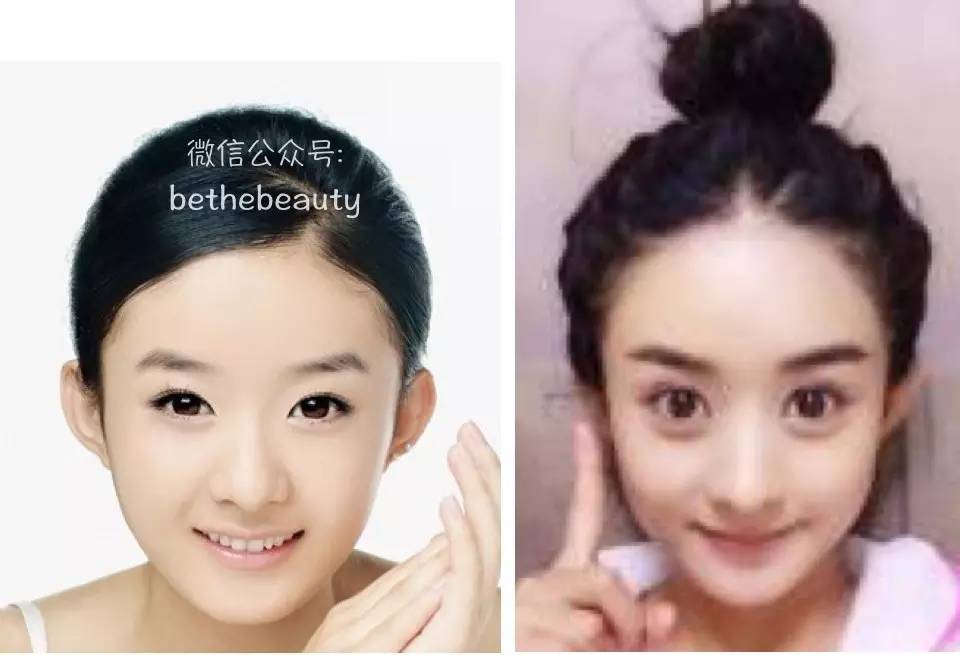 男生脸大怎么变小脸不整容,不靠化妆整容能把脸部骨骼变美