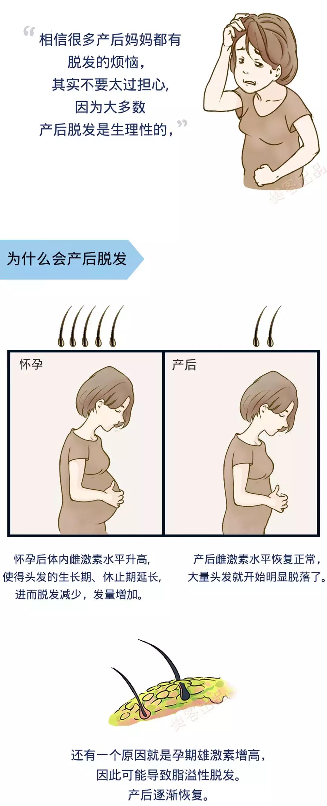 产后脱发是因为妈妈缺营养嘛,产后脱发特别严重是因为抑郁吗