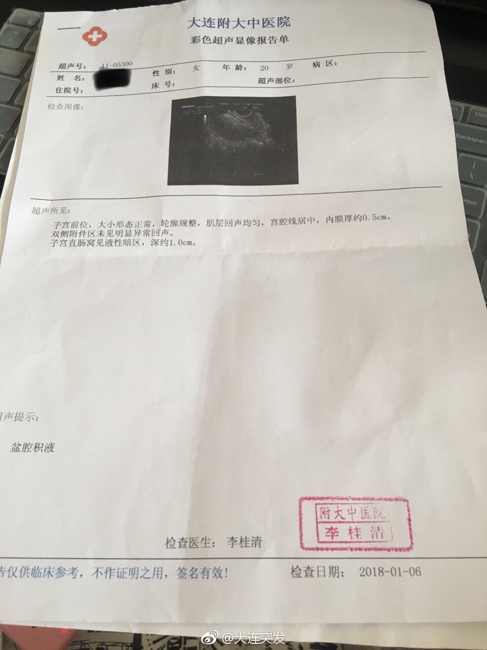 做个妇科活检多钱,做个妇检要多少钱