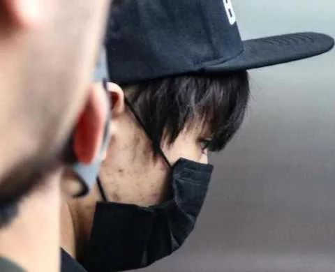 男生祛痘去痘印去油,如何祛痘印男士