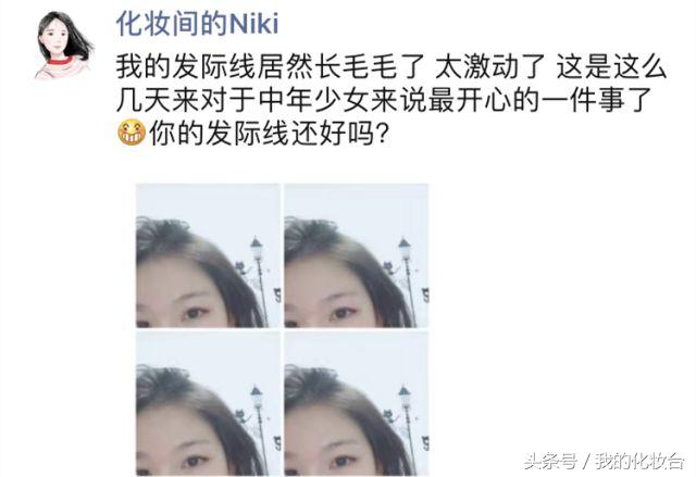 脱发严重怎么让头发蓬松,头发容易贴头皮教你一招