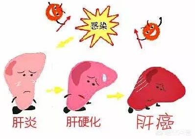 转氨酶高血脂高要注意什么,转氨酶高注意吃什么食物好