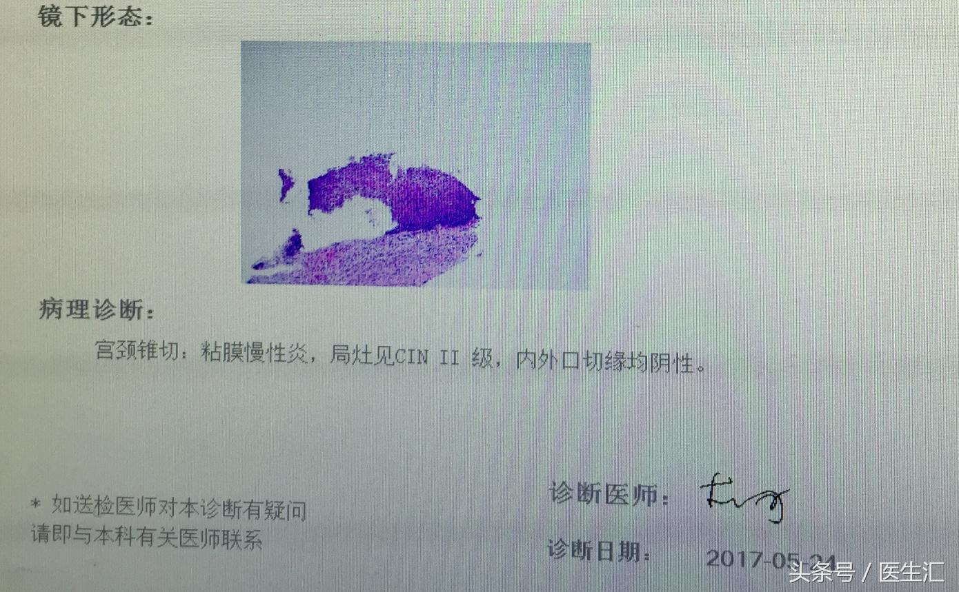 月经量多、阴道出血！小心子宫腺肌症！