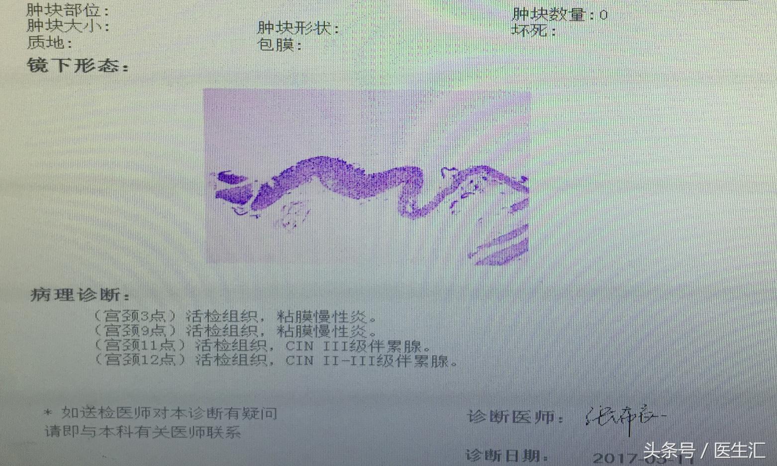 子宫腺肌症中医病历,子宫腺肌病疑难病例分析报告