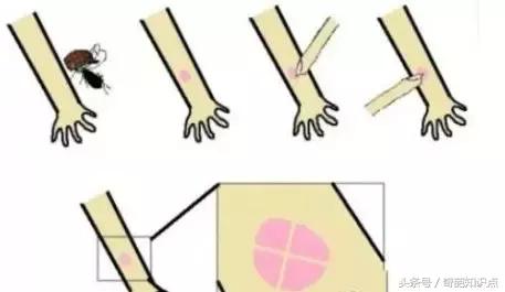 脸被人打了一巴掌可以报警吗,脸被人打了一拳腮帮子疼