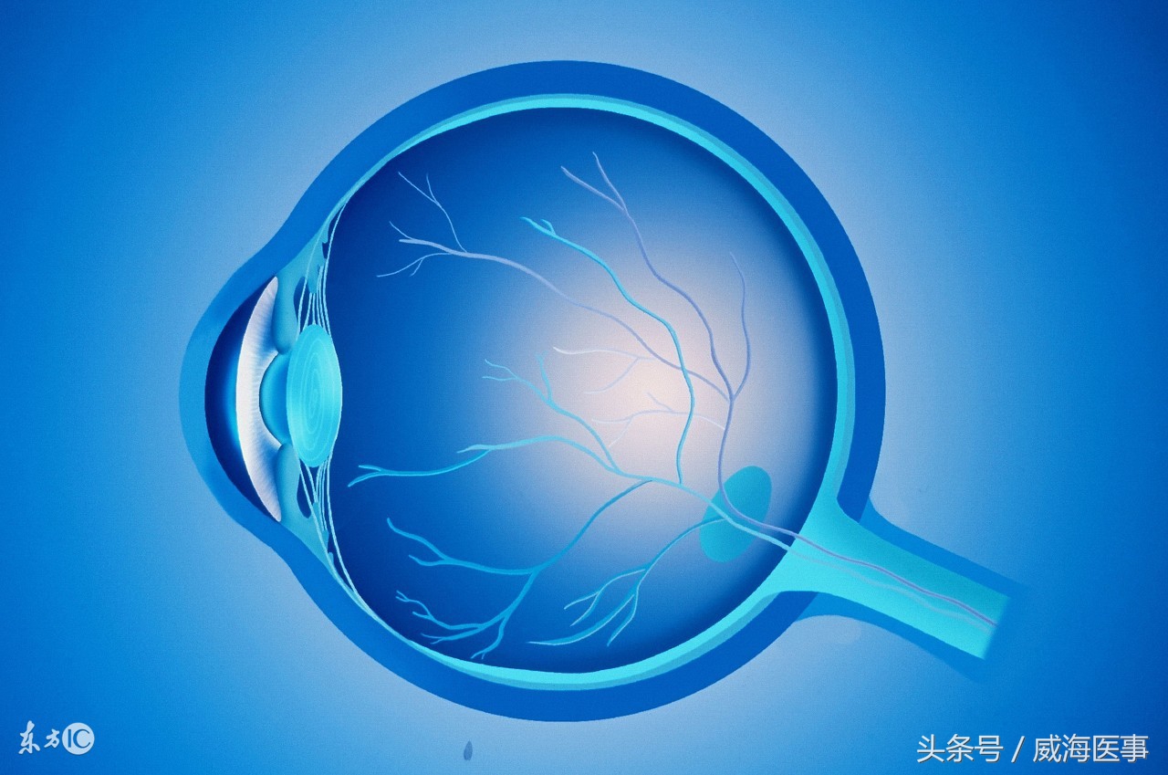 飞蚊症到底会不会导致失明,老年人飞蚊症能引起失明吗