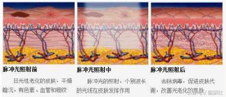 温顺谦和大妈修炼计——扼制颈部老化
