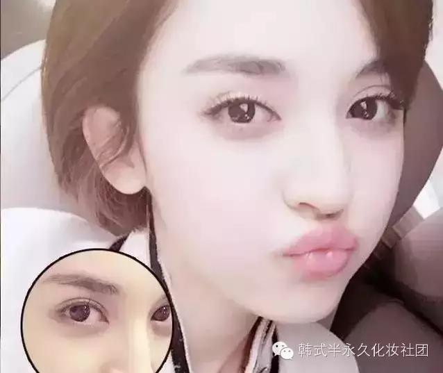 纹美瞳线七天脱痂过程图,纹美瞳线掉痂后反色过程图