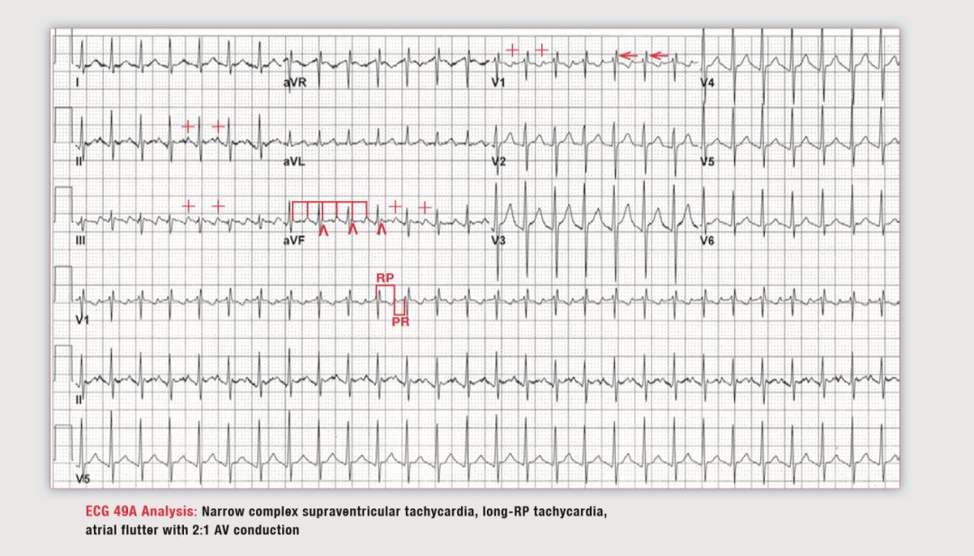 读心有术视频讲解,读心有术十二句话