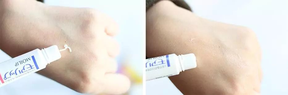 男士嘴唇干裂脱皮怎么回事,男士嘴唇干裂脱皮怎么办