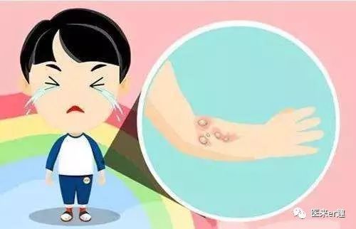 谁不受伤谁的过往，史上最全外伤科普集锦