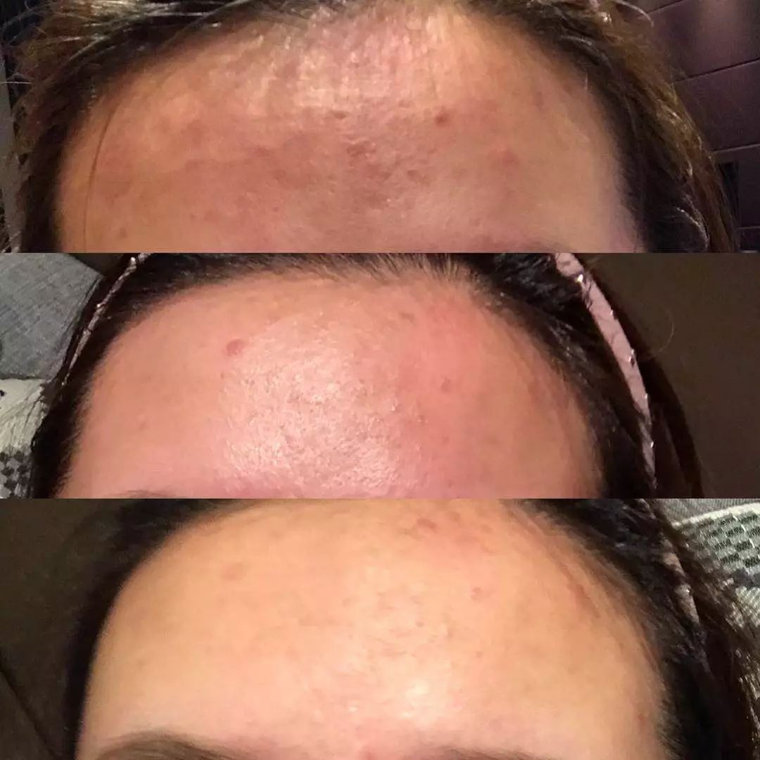 平价又好用护肤品纠结选哪个,各种肤质都适合的护肤品推荐列表