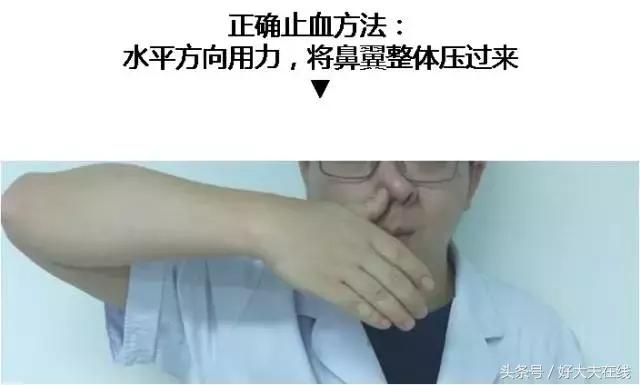 鼻血一直流怎么快速止血的方子,鼻血流不停怎么快速止血