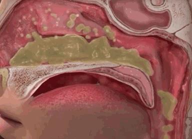 宝宝咳嗽晚上反复哭闹,宝宝咳嗽晚上更厉害了怎么办