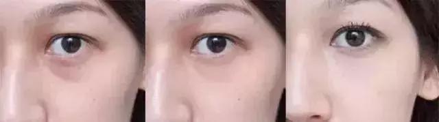 濞滄墡寮犵堪鍒嗘墜鏄湡鏄亣,濞滄墡寮犵堪鍒嗘墜浜嗗悧